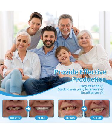 Smilify Custom-Fit Cosmetic Teeth Covers for Women and Men Personalized Clip-on Smile Accessory DIY Fitting Set - Removable Temporary Smile Enhance Prop - Buy Online on GoSupps.com