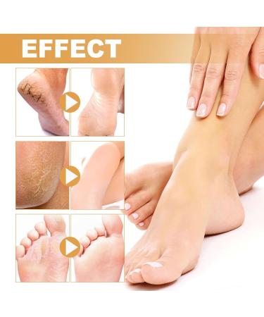 Tongyend Foot Peeling Spray Instant Foot Peeling Spray Foot Callus Removal Spray Moisturizing Hydrating Nourish Peel off Spray Foot Exfoliating Spray Remove Foot Dead Skin-30ML FootCallusRemover - Buy Online on GoSupps.com