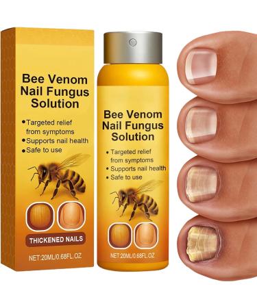 Nail Recovery SprayMoisturizing Natural Nail Recovery Spray Deep Cleansing Care Travel Size For Damaged Nails Women Men Adults Elderly - Buy Online on GoSupps.com