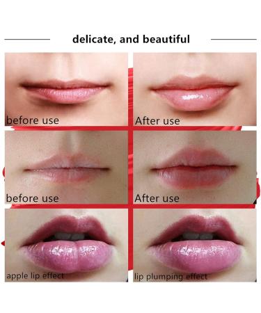 2023 Women's Electric Lip Plumper | USB Charging Lip Plumping Machine for Plumper Lips | Lip Care Tool for Girls and Women - Buy Online on GoSupps.com