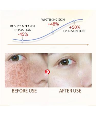 Glutathione Face Cream Freckle Remover Cream Dark Spot Correcting Glow Serum Dark Spot Corrector Correct Black Spots and Brighten the Skin Facial Dark Spots Remover - Buy Online on GoSupps.com