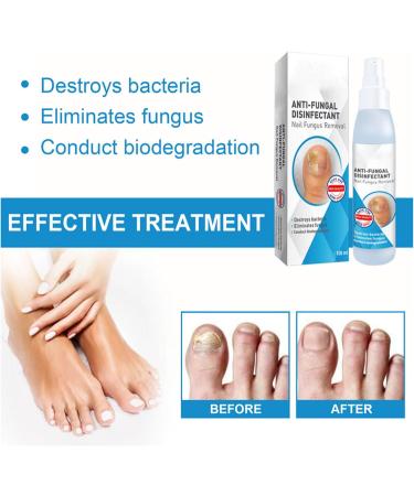 WJnflQN Nail StrengtheningFoot Nail Nourishing Spray 100ml Nonsticky Strengthening Spray for Damaged Cracked Brittle Nails for Daily Hand and Foot Care - Buy Online on GoSupps.com