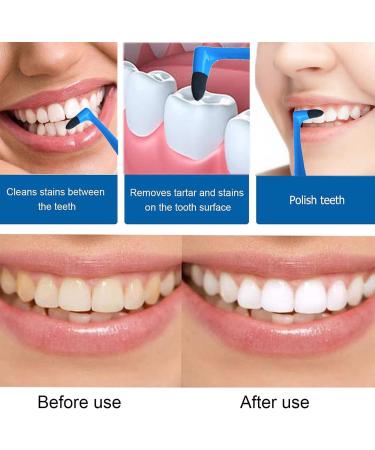 Olakin Tartar Removal Kit - 5 Pack | Effective Teeth Whitener & Stain Remover | Tartar Removal Tool (Mixed Colors) - Ship Worldwide - Buy Online on GoSupps.com
