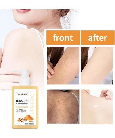 FAYNDE Turricum Body Cream 100ml - Nourishing Daily Skin Care with Ginger Extract for Women & Teens | Ideal for Back Neck Shoulders Arms & Legs - Buy Online on GoSupps.com