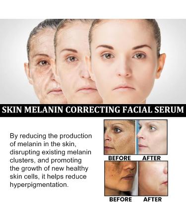 2023 Melanin Correcting Facial Serum & Dark Spot Corrector - Daily Face Serum (2pcs) - Buy Online on GoSupps.com