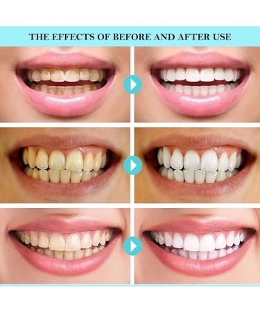 Niacinamide Whitening Toothpaste - Enamel Safe Formula for Brighter Teeth & Stain Removal Fresh Breath Vegan Fluoride-Free with Fresh Mint - Buy Online on GoSupps.com