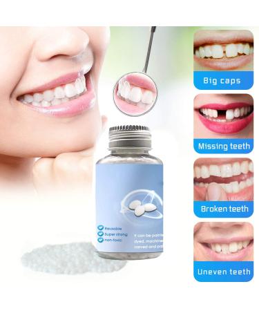 False Tooth Repair Kit with Thermal Fitting Beads - Snap On Instant Smile - Denture Adhesive - Buy Online on GoSupps.com