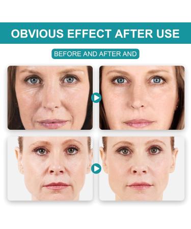 Trendyfave Retinol Moisturiser Cream Collagen Face Cream with Retionl 5% Hyaluronic Acid and Vitamin E Smoothes Wrinkles Day and Night Cream Firming Retinoid Cream - Buy Online on GoSupps.com