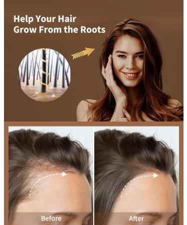 VTS Hair Serum Applicator Set - Rosemary & Moroccan Argan Oil for Hair Growth | Scalp Massager for Men & Women - Buy Online on GoSupps.com