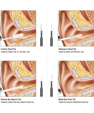 Rehomy Digital LED Otoscope Ear Camera - Earwax Removal Kit & Cleaning Tool for Perfect Ear Care - Buy Online on GoSupps.com