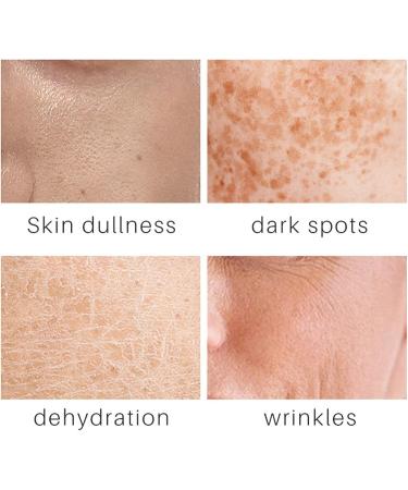  Eastuy Carrot Face Essence 30 ml Carrot Essence for Face - Hydrating Smoothing Face Oil Natural Make-Up Remover Cream Brown Spots - Buy Online on GoSupps.com