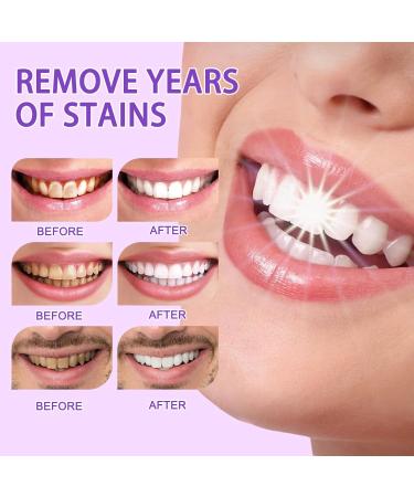 IJGD Purple Toothpaste for White Teeth - Effective Color Correction & Whitening Serum - Buy Online on GoSupps.com