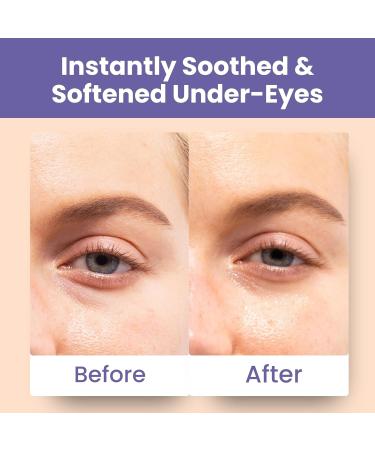 Patchology Skin Remedy Soothing Eye Gels Ultra-Soft Hydrogel Undereye Masks with Ectoin Ceramides & Botanical Blend Hydrate Revive & Refresh Puffy & Tired Eyes For All Skin Types (5 Pack) 1 Count (Pack of 5) - Buy Online on GoSupps.com