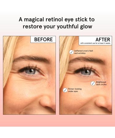 grace & stella Under Eye Brightener Balm Stick - Travel Size Toiletries - Retinol & Caffeine Eye Cream for Dark Circles Puffiness Wrinkles - Restore and Hydrate - Vegan Skincare (0.13oz / 3.5g) Restoring Eye Balm (3.5g /  - Buy Online on GoSupps.com