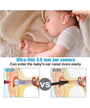 SMSOM Ear Wax Removal Ear Cleaner 1920P HD Wireless Ear Otoscope Earwax Removal Tool Safe Ear Wax Removal Kit for Adults Kids &Pets Black - Buy Online on GoSupps.com