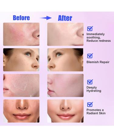 30e Salmon DNA PDRN Anti-Aging Facial Serum + 5ea Madecassoside Sheet Mask Blemish Repair - Buy Online on GoSupps.com