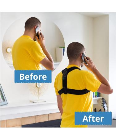 Cayatch Scoliosis Back Brace Posture Corrector - Adjustable Shoulder & Back Support for Women & Men - HSA/FSA/HRA Eligible - Black - Buy Online on GoSupps.com