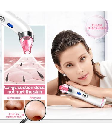Pore Vacuum Facial Cleaner with 5 Suction Power Probes for Blackhead, Acne, and Whitehead Removal - Pink - Buy Online on GoSupps.com