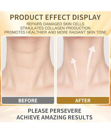 Anti Aging Firming Neck Cream 5-IN-1 Face Tighten and Lift Neck Cream Anti Wrinkle Neck Retinol & Collagen Cream Chest Neck & Face Lifting|Repairing|Moisturzing Skin Care for Men & Women - New Green - Buy Online on GoSupps.com