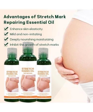 Body Oil for Women - Body Skin Care - Body Oil for Stretch Marks Removal - Moisturizing Firming Nourishing Body Oil - Stretch Mark Oil - Reduce Fine Lines & Restore Skin Elasticity - Mum to Be Gifts - Buy Online on GoSupps.com