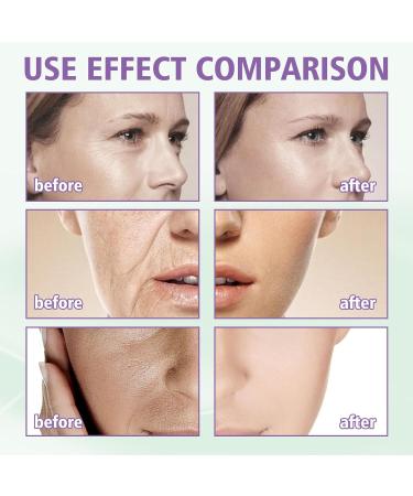 Hyaluronic Acid Serum for Face Face Serum Skincare for a Rejuvenated Skin - Collagen Serum for Face for Sensitive Skin - Buy Online on GoSupps.com