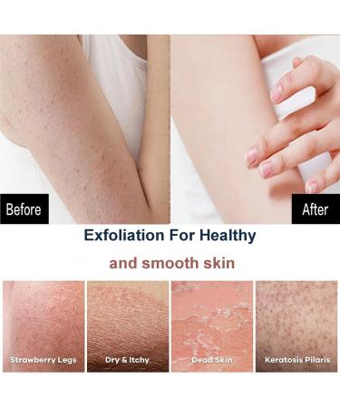 Loofah Sponge & Exfoliating Mitt Set - 2pc Deep Exfoliating Glove for Men & Women | Shower Scrubber & Dead Skin Remover - Buy Online on GoSupps.com