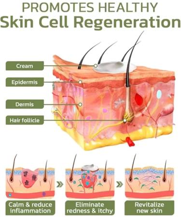 DUBUSH Keratosis Hair Cream Hair Follicle Repair Cream Chicken Skin Smoothing Cream Keratosis Hair Treatment Cream for Rough and Dented Skin - Buy Online on GoSupps.com