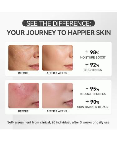 Morovan Tallow PDRN Repair Cream 3D Hyaluronic Acid & Natural Tallow Face Moisturizer for Skin Barrier Repair Intense Hydration & Anti-Aging 1.7 oz - Buy Online on GoSupps.com