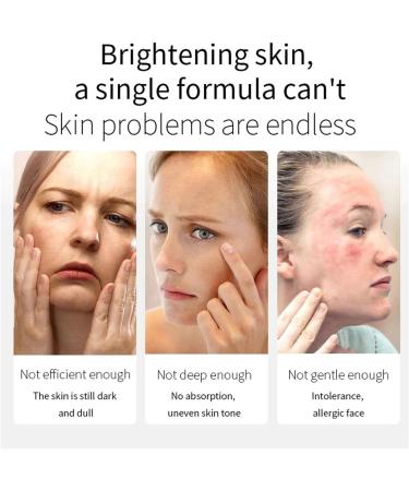 Watermelon Niacinamide Hydrating Face Serum - Moisturising & Brightening Serum Watermelon Glow Toner with Hyaluronic Acid to Hydrate Brighten Tighten Pores and Base Makeup Liquid Highlighter 30ml - Buy Online on GoSupps.com