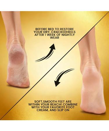 Repair Cream for Cracked Heels 60g Soothing Balm Repair Balm for Cracked Heels For Women and Men Travel Skin Care Pedicure Soothing Peeling Moisturizing - Buy Online on GoSupps.com
