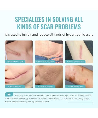 Advanced Scar Gel Treatment | Silicone Scar Removal Cream for Face C-Section Keloids & Acne Scars - Fast Shipping Worldwide - Buy Online on GoSupps.com