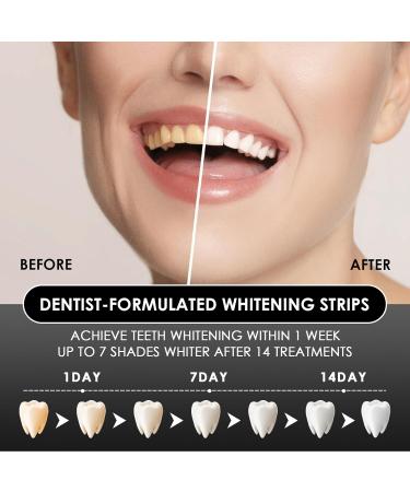 Kit De Blanchiment Des Dents Bandes Blanchissantes Douces Pour Les Dents Gel Blanchiment Dentaire Effet Domicile Aide Eliminer/Fumer/Caf /Soda/Vin Tache (Charbon De Bambou) Noir - Buy Online on GoSupps.com