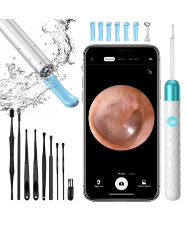 Jaydear Ear Cleaner/Ear Wax Removal Kit Ear Camera 1920P FHD Wireless Otoscope Portable USB Charging Kit with LED Lights Ear Cleaning kit for iPhone & Android Smart Phones - Adults Kids Pets White