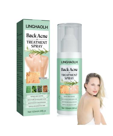 Back Acne Treatment Body Spray Moisturising Body Acne Cleanser Spray for Women & Men