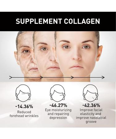 Retinol Moisturizer Face Cream with 2.5% Active Retinol Hyaluronic Acid Vitamin E and Green Tea Anti-Aging Formula 1.7 oz - Buy Online on GoSupps.com