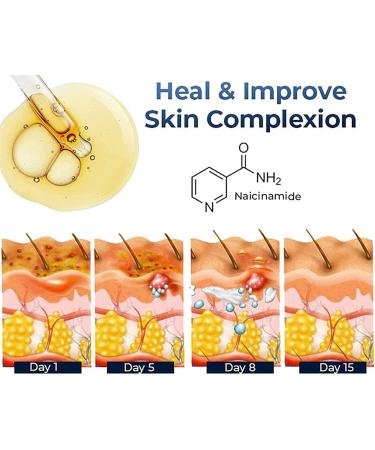 GFOUK Eczema Therapy Spray All Natural Eczema Treatment Psoriasis Treatment Skin Care Pain & Itch Spray Fast Acting Itch Relief (2PC) - Buy Online on GoSupps.com