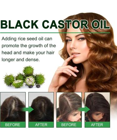 Organic Castor Oil Organic Black Castor Oil for Hair Growth Cold Pressed Castor Oil Promote Hair Growth Strengthen Hair Roots and Prevent Bifurcation 30ML - Buy Online on GoSupps.com