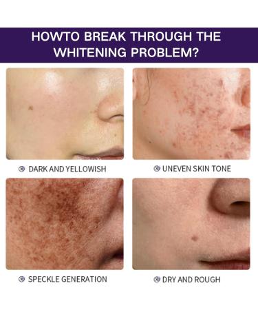 Dark Spot Correcting Glow Serum - Face Serum for Women - Dark Spot Remover for Face - Hydrating Serum for Moisturizing Smoothing Firming - Tone Balancing Essence - Face Care&Skin Care - Buy Online on GoSupps.com