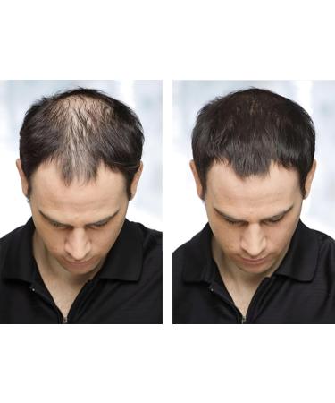 Hair Building Fibers 27.5G - Thickening Fibers for Thin & Fine Hair - Unisex Hair Fibers in Black - International Shipping Available - Buy Online on GoSupps.com