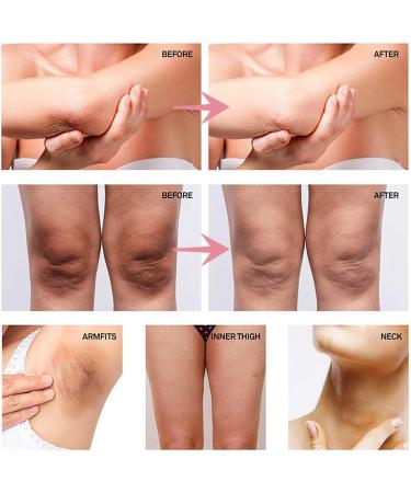 Nicotinamide Underarm Whitening Cream Body Whitening Cream Underarm Armpit Brightening Cream Fade Hyperpigmentation Skin Lightening Cream Dark Spot Corrector Cream for Neck Knee Bikini Armpit Joint - Buy Online on GoSupps.com
