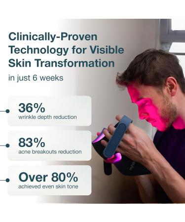 myhalos LED Face Mask Light Therapy Red Light Therapy Mask for Wrinkles Blemishes & Anti-Aging Face Light Therapy Mask for Skin Rejuvenation Cordless with Infrared & Blue Light - Buy Online on GoSupps.com