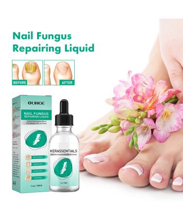 2Pcs Kerassentials Toenail Treatment - Extra Strength for Damaged and Discolored Nails - Buy Online on GoSupps.com