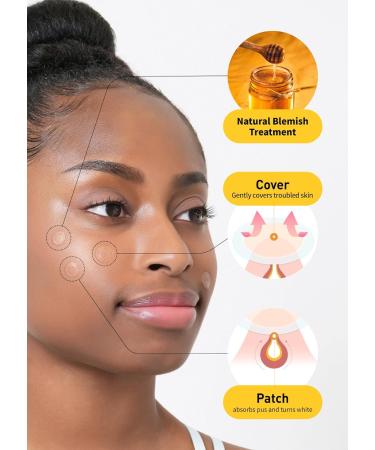 OLIVE YOUNG Care Plus Honey Scar Cover Pimple Patches 2 Pack - 168 Hydrocolloid Patch Spot Stickers with Manuka Honey for Acne and Blemishes - Buy Online on GoSupps.com