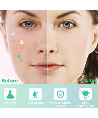Star Pimple Patches - 240 Hydrocolloid Acne Dots with Tea Tree Oil | 3 Sizes & 6 Colors for Blemish Relief - Buy Online on GoSupps.com