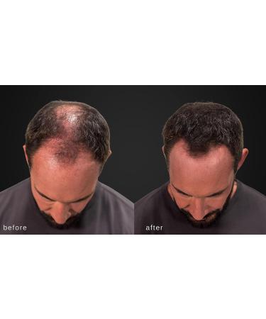 LUXE Hair Thickening Fibers - 2 Months+ Supply in Gray | Hypoallergenic & Dermatologist Tested for Confidence Boost - Buy Online on GoSupps.com