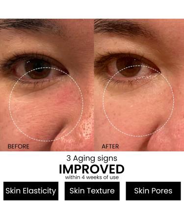 Organic Resurfacing Retinol Serum with Hyaluronic Acid & Vitamin E | Anti Wrinkle, Sun Damage Repair | Improve Elasticity & Radiance - Buy Online on GoSupps.com