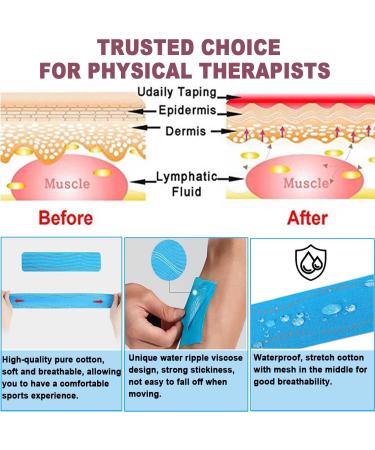 ATETEO Kinesiology Tape D-Camo Pink Medium Size 5m x 3.8cm - Buy Online on GoSupps.com