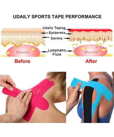 Jabtraxx 6 Roll Kinesiology Tape (5m x 5cm) - Ultimate Muscle Support Band with E-Book & Application Examples - Elastic Strapping Band 6er Mix Set for Optimal Performance - Buy Online on GoSupps.com