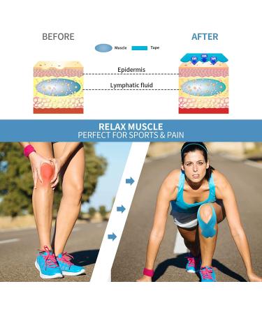 REFUN Kinesiology Tape Precut - 4 Rolls Pack for Pain Relief | Waterproof, Latex Free | 2 x 16.5 ft Per Roll | Ideal for Knee, Shoulder, Elbow | 20 Pre-cut 10 Strips - Beige - Buy Online on GoSupps.com