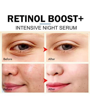 Retinol Face Night Serum Anti Wrinkle Serum Retinol Serum for Face Retinol Face Serum Face Moisturizer for Women Hydrating Serum Dark Spot Remover Anti Age Serum Plump and Smooth Skin - Buy Online on GoSupps.com
